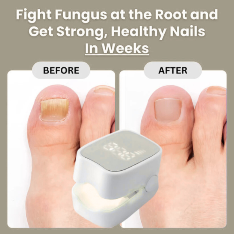 Drova™ - Nail Fungus Laser Device